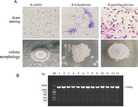 bacillus subtilis negative stain|Isolation, identification and characterization of novel .